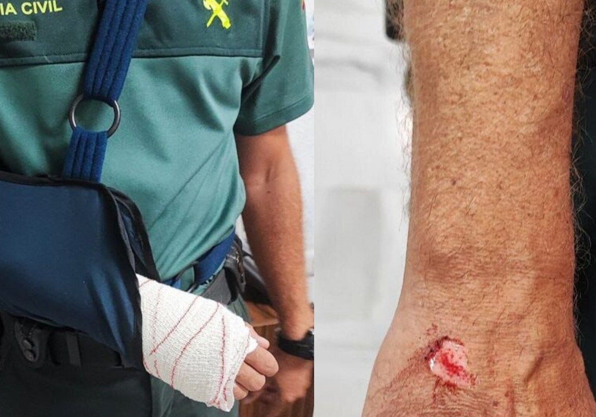 Una de las agresiones cometidas contra un guardia civil en Cádiz.