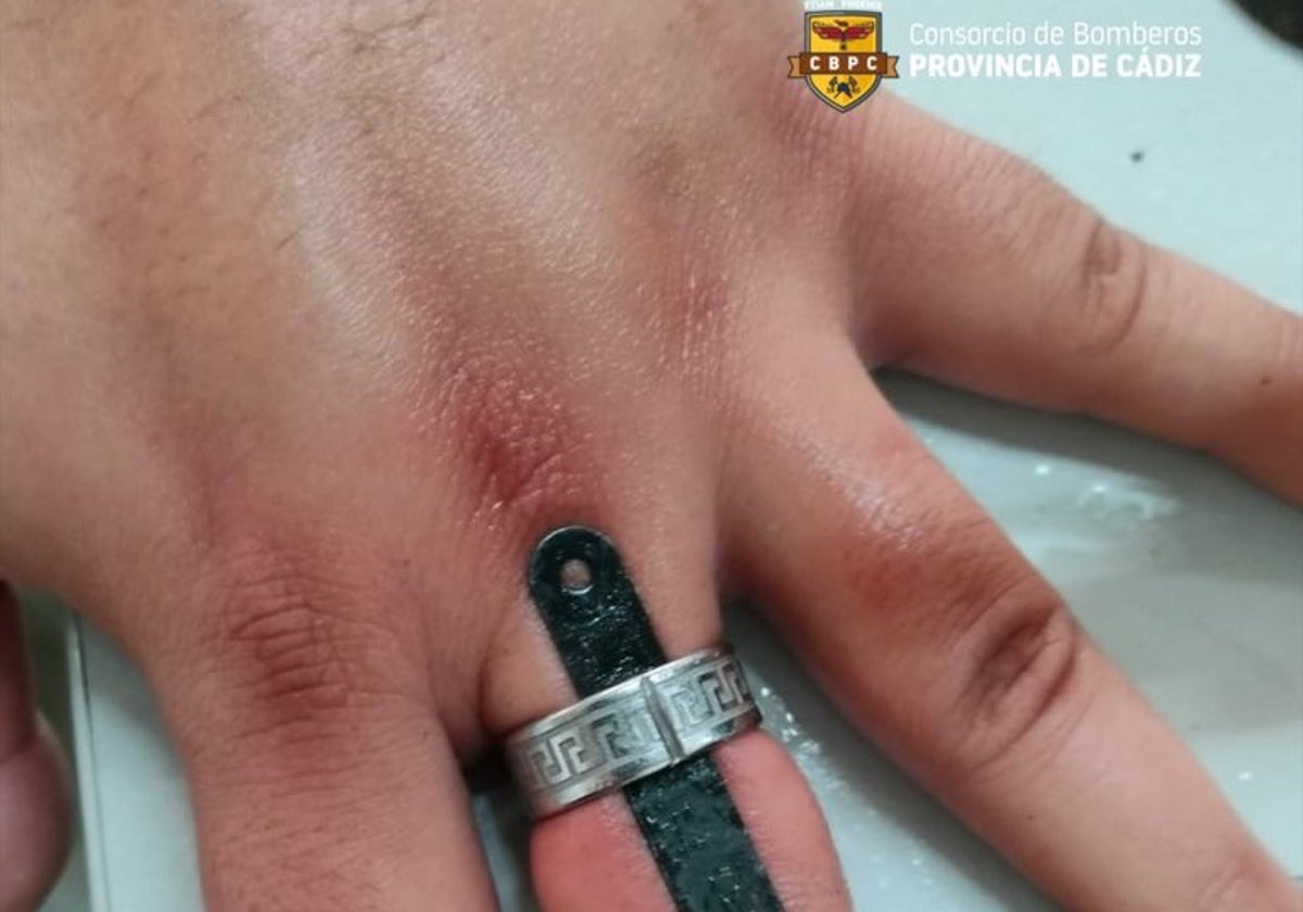 El anillo de acero que no se podía cortar de la mano de un hombre