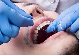 Condenan a un árbitro de fútbol y a un taxista de Cádiz por ejercer como dentistas sin título