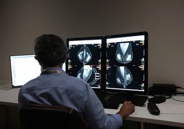 Un total de 200 mujeres del Hospital de Jerez, citadas para completar el cribado del cáncer de mama