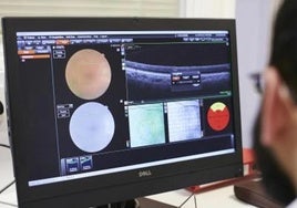 Uno de cada tres afectados por glaucoma en Cádiz no sabe que lo padece