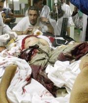 José Couso a su llegada al hospital junto a su compañero de Tele 5 Jon Sistiaga