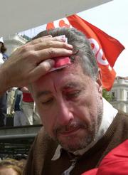 José María Fidalgo, herido en la manifestación del 1 de mayo