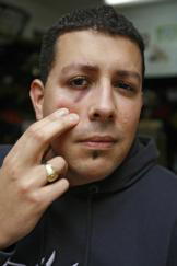 Alonso muestra las secuelas de la paliza. NIEVES SANZ