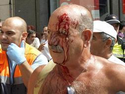 Imagen de una de las nueve personas que han resultado hoy atropelladas. /EFE