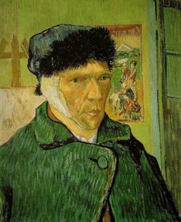 La Oreja de Van Gogh' confiesan el varapalo que supuso la marcha