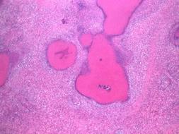 Imagen de la bacteria mycoplasma / ABC