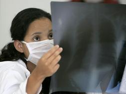 «El 40% de las muertes por gripe A son jóvenes adultos con buena salud»