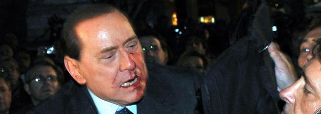 Berlusconi, tras la agresión, cree que todo ha sido un milagro