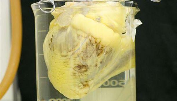 Asi es el corazón bioartificial español