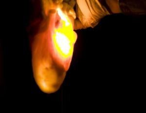 El corazón humano, al desnudo