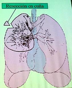España, aliviada por la buena salud del Rey