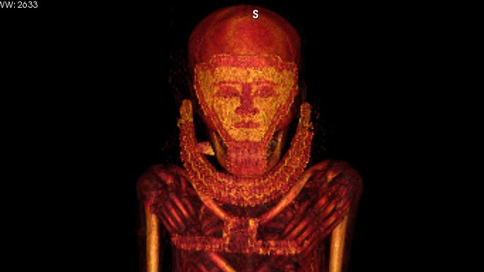 La Universidad de Jaén descubrió a las momias que sufrieron cáncer