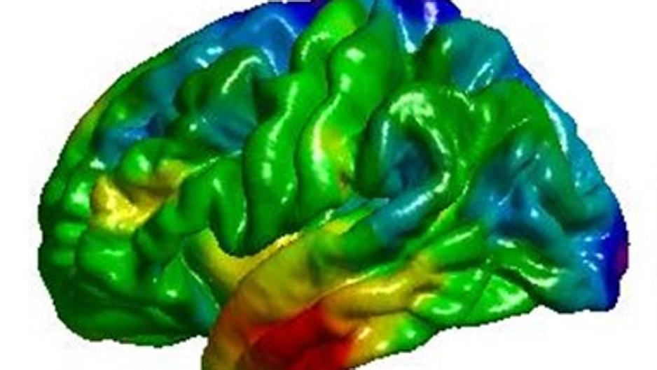 El tabaco o la obesidad influyen en el deterioro del cerebro
