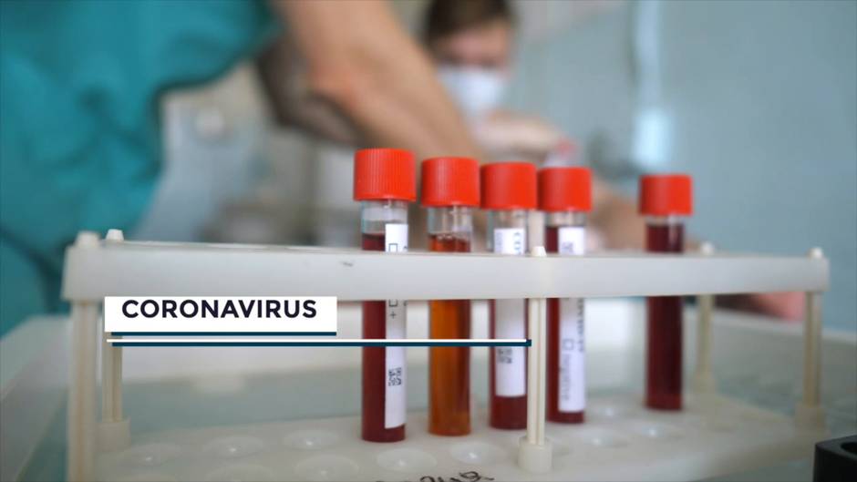 Según los datos de Sanidad, aumenta en 119 positivos en coronavirus en la comunidad andaluza