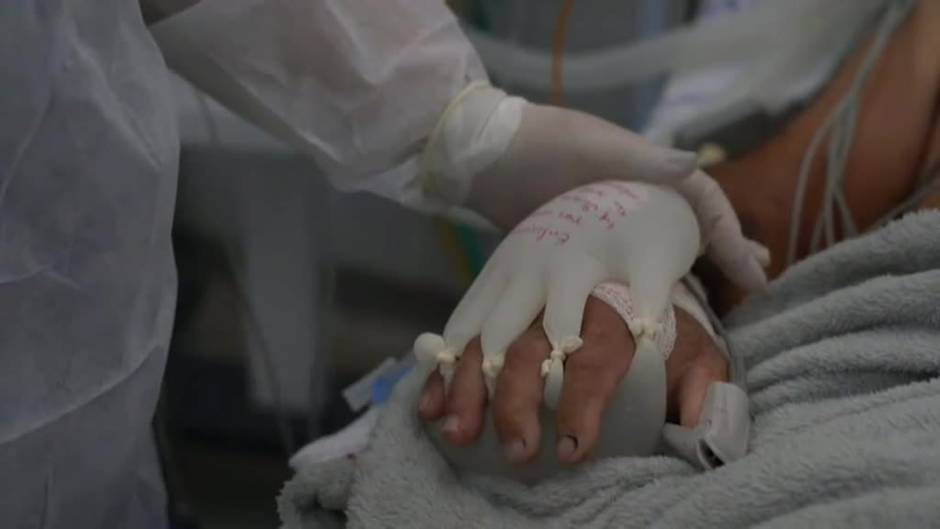 Los hospitales de Brasil recurren a la técnica 'manitas de amor' que son guantes de látex llenos de agua tibia