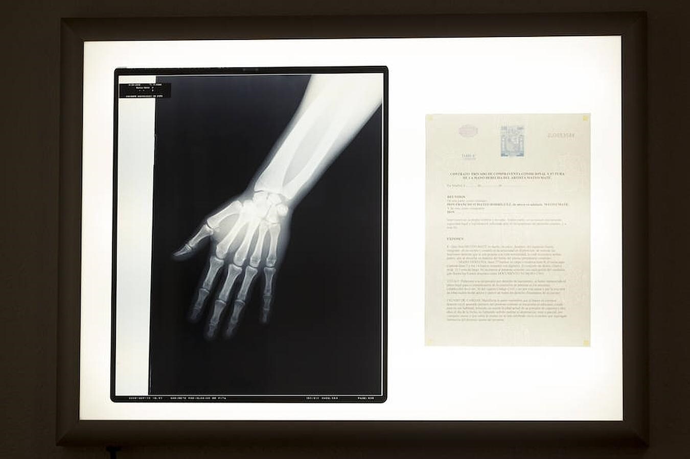 «Reliquias de artista», caja de luz con las radiografías del cuerpo del artista, su propuesta en ARCO con la galería NF