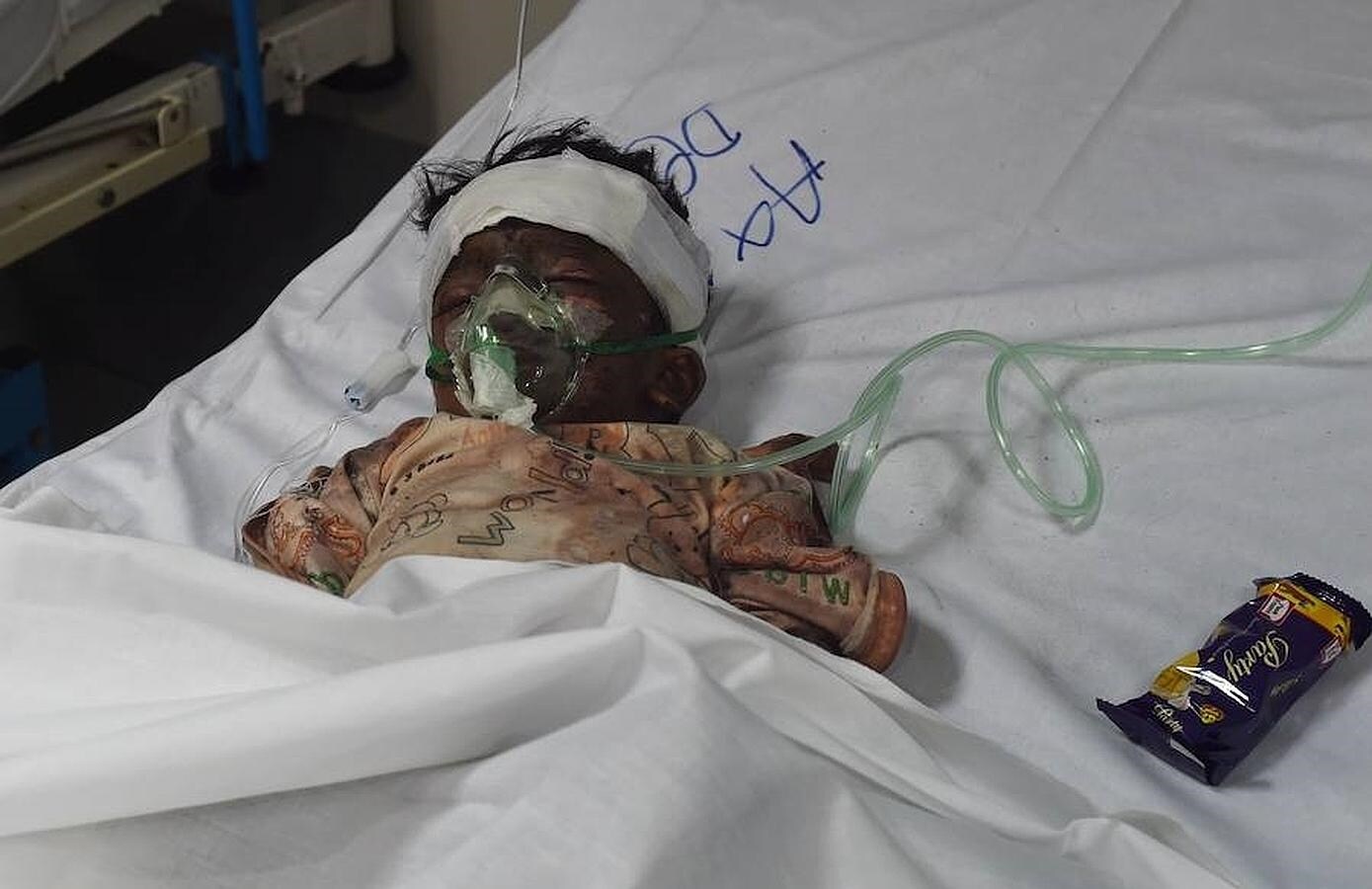 Un bebé que resultó herido tras el atentado terrorista en Pakistán se recupera en un hospital de la zona