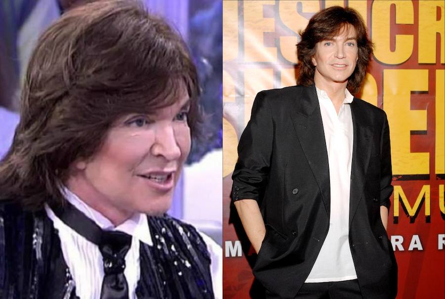 Es sonadísimo el cambio de cara de Camilo Sesto. 