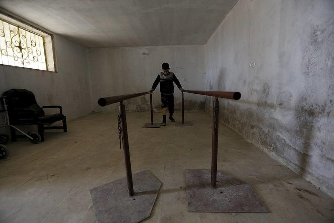 Un niño con una pierna amputada realiza ejercicios con su prótesis. 