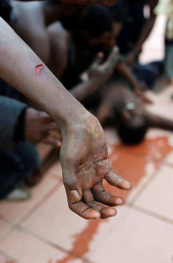 La mayoría de los heridos presentaban contusiones y cortes. Reuters