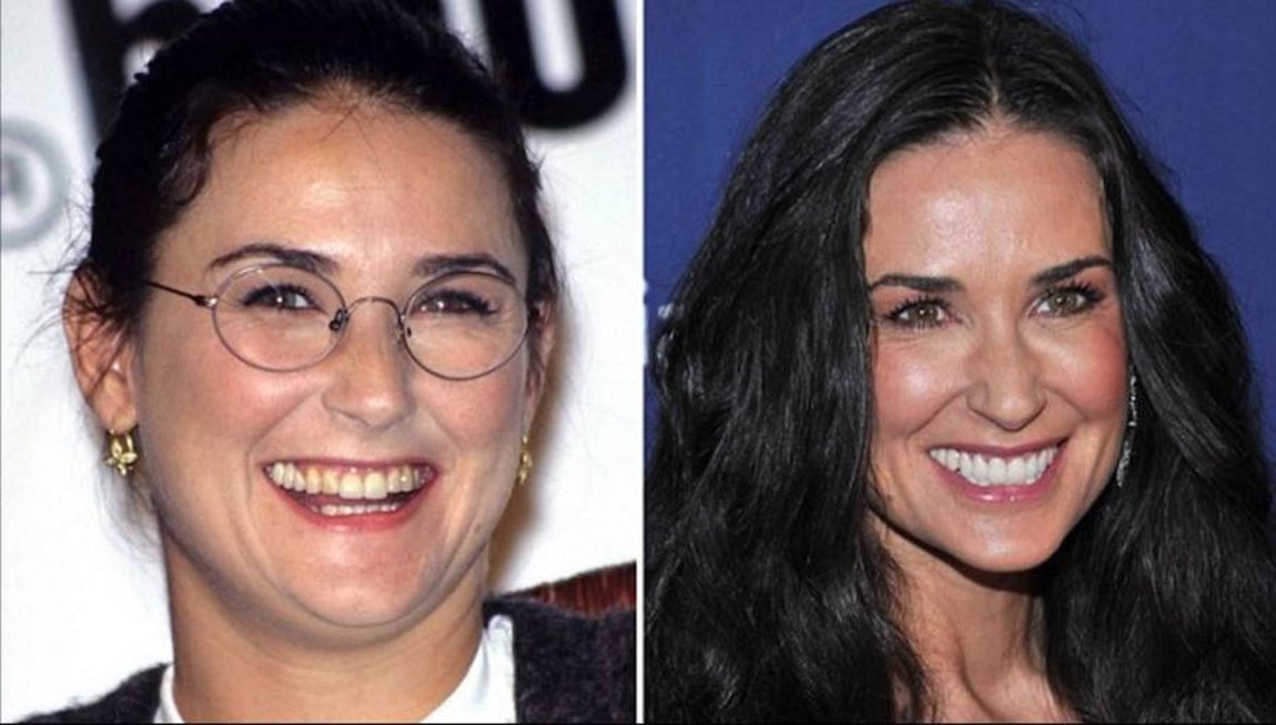 Demi Moore. 