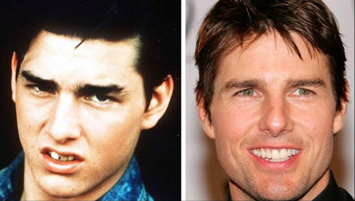 Tom Cruise. 