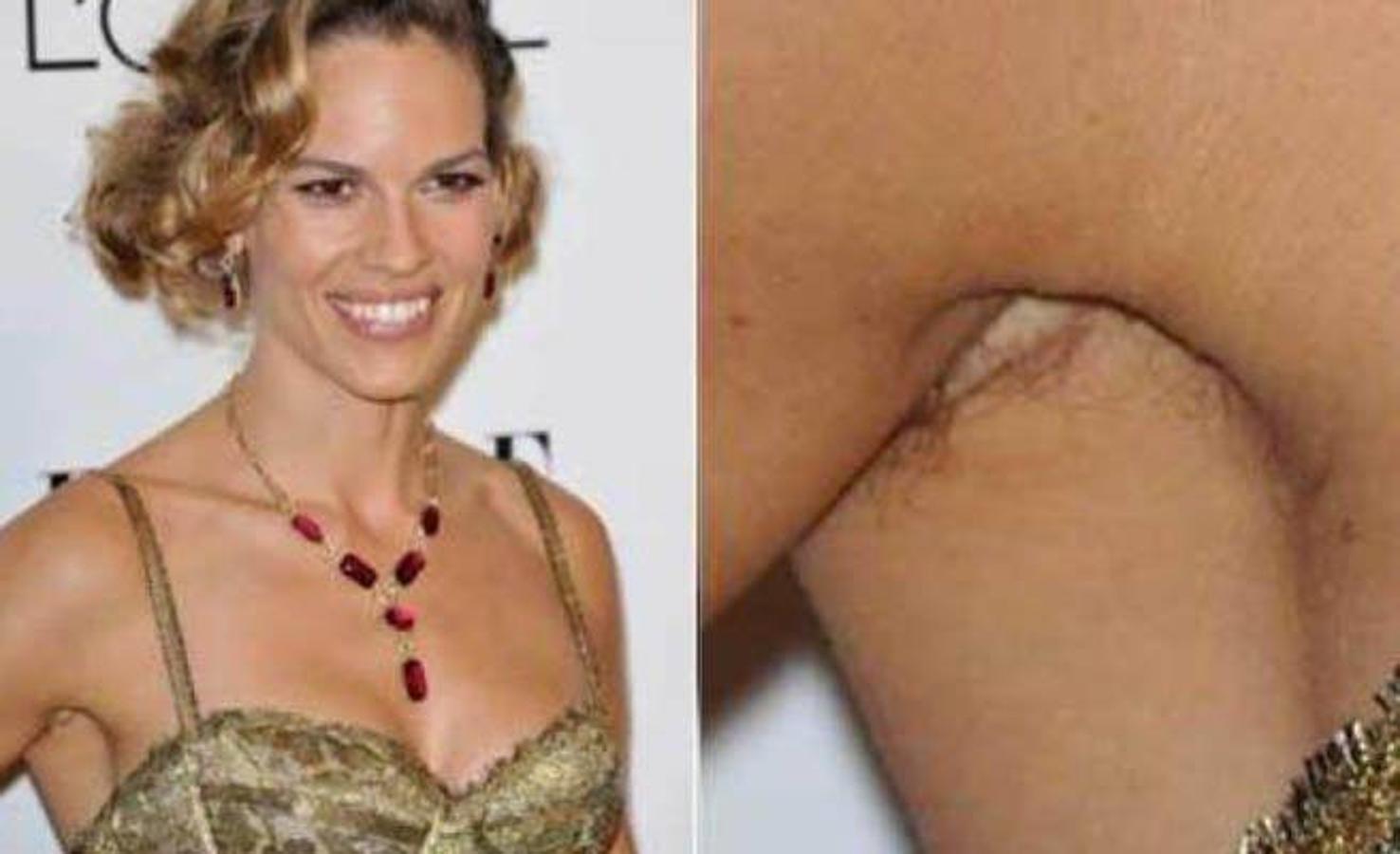 Hillary Swank, actriz. La intérprete caminó por la alfombra roja con un vestido de oro precioso y un exceso de vello en sus axilas