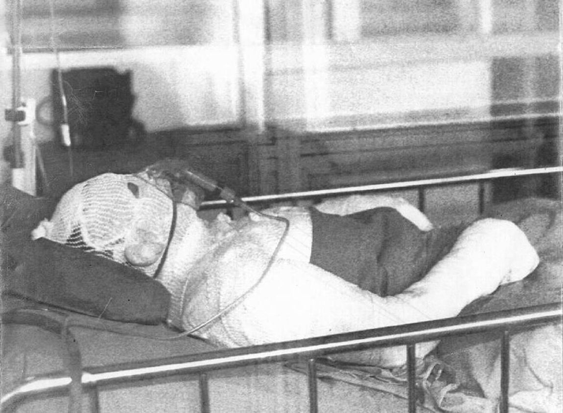 Un herido quemado y tumbado en la camilla totalmente vendado. 