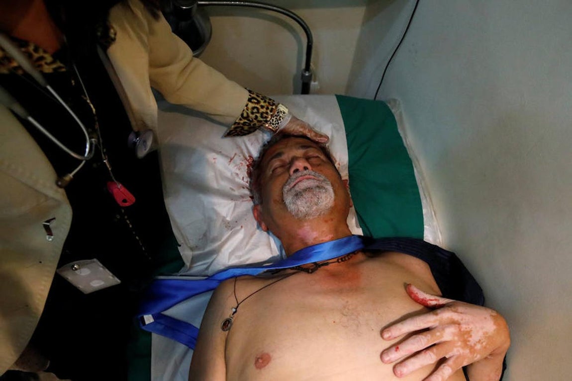 El diputado opositor, Americo de Grazia, tras el asalto de los partidarios de Chávez al parlamento venezolano. Reuters