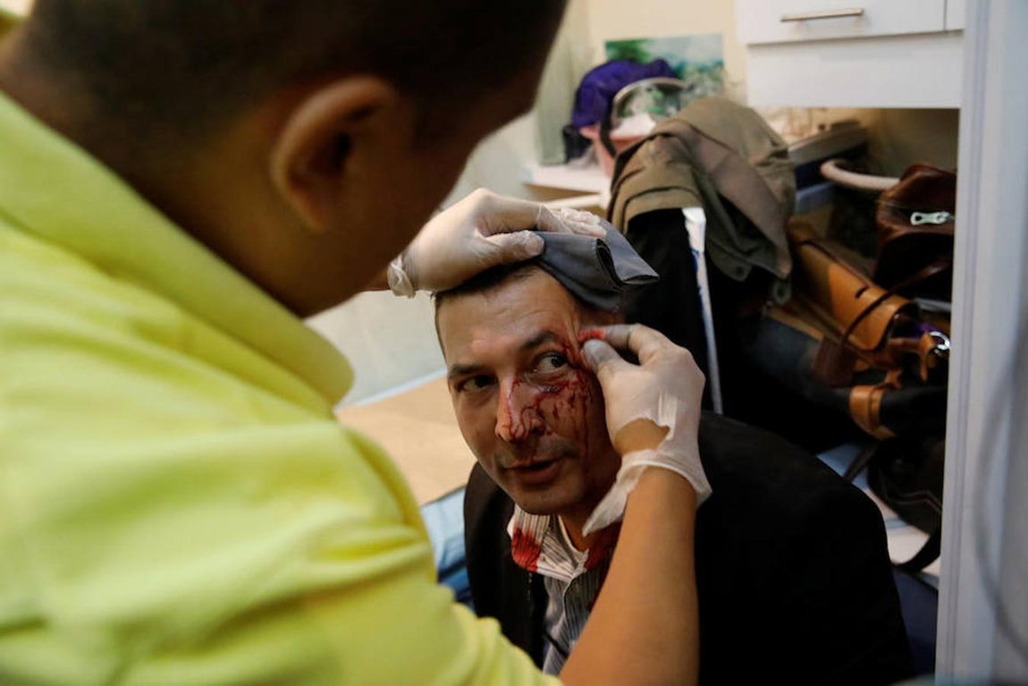 Los partidarios de Chávez han agredido brutalmente a diputados de la oposición. Reuters