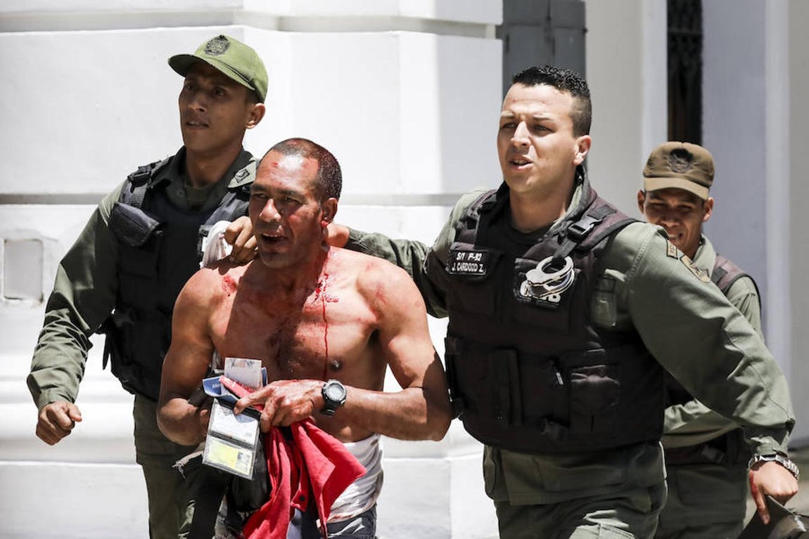 Un simpatizante del Gobierno, que resultó herido, es retirado de la Asamblea Nacional.. 