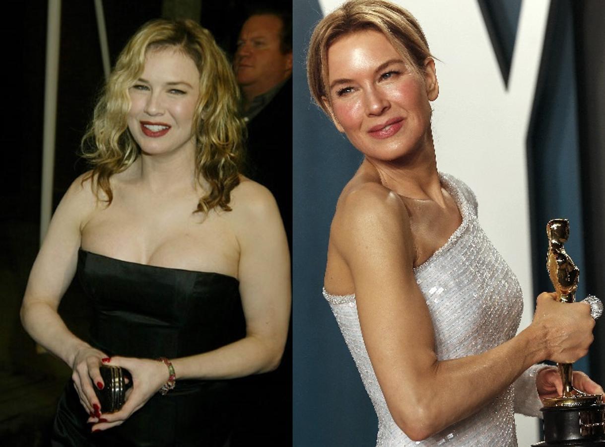 Renée Zellweger. 