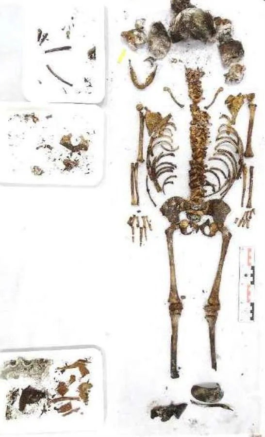 Conjunto del material óseo encontrado