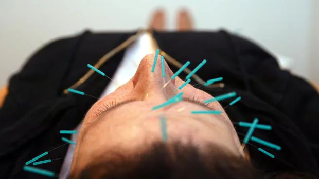 Rafael Cobos: «Los del Ministerio de Sanidad están mal asesorados; la acupuntura es una ciencia»