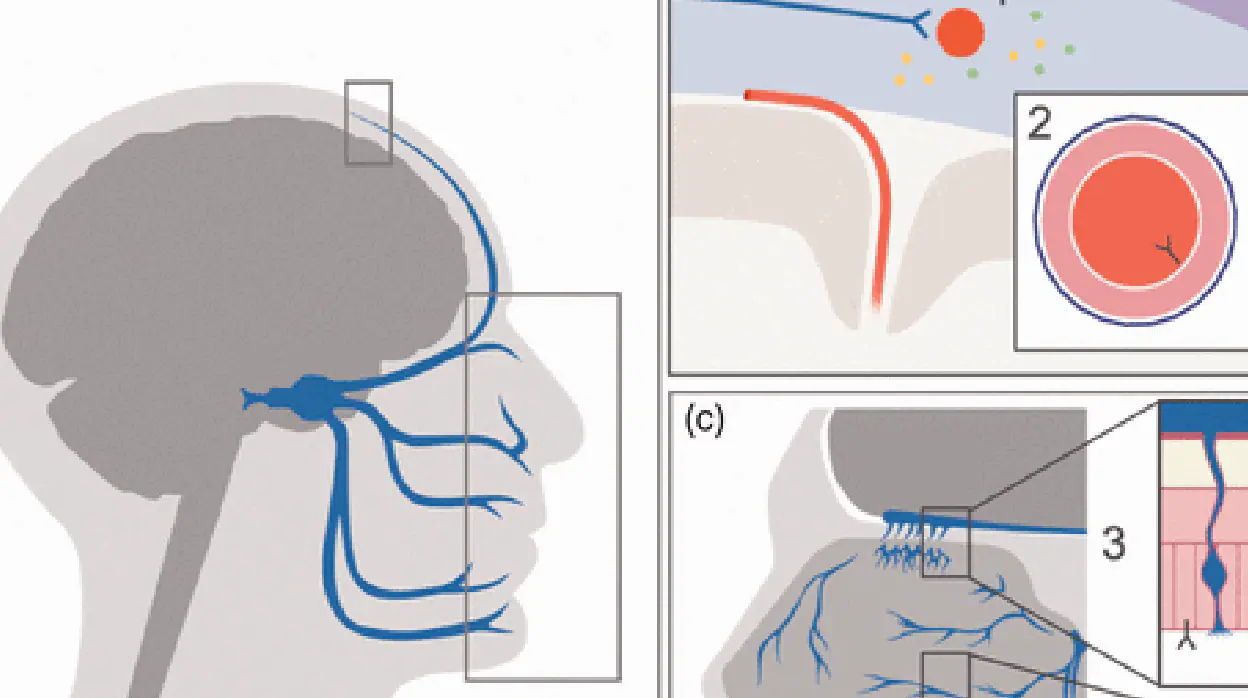 Posibles mecanismos fisiopatológicos de la cefalea asociada a Covid-19