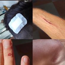 Algunas imágenes difundidas por la víctima en redes sobre las heridas sufridas durante la agresión