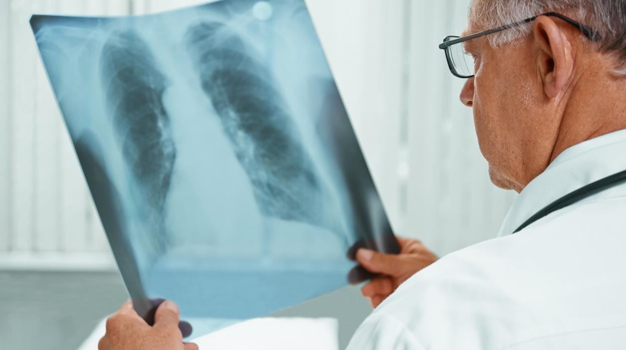 Un doctor examina una radiografía de los pulmones de un paciente