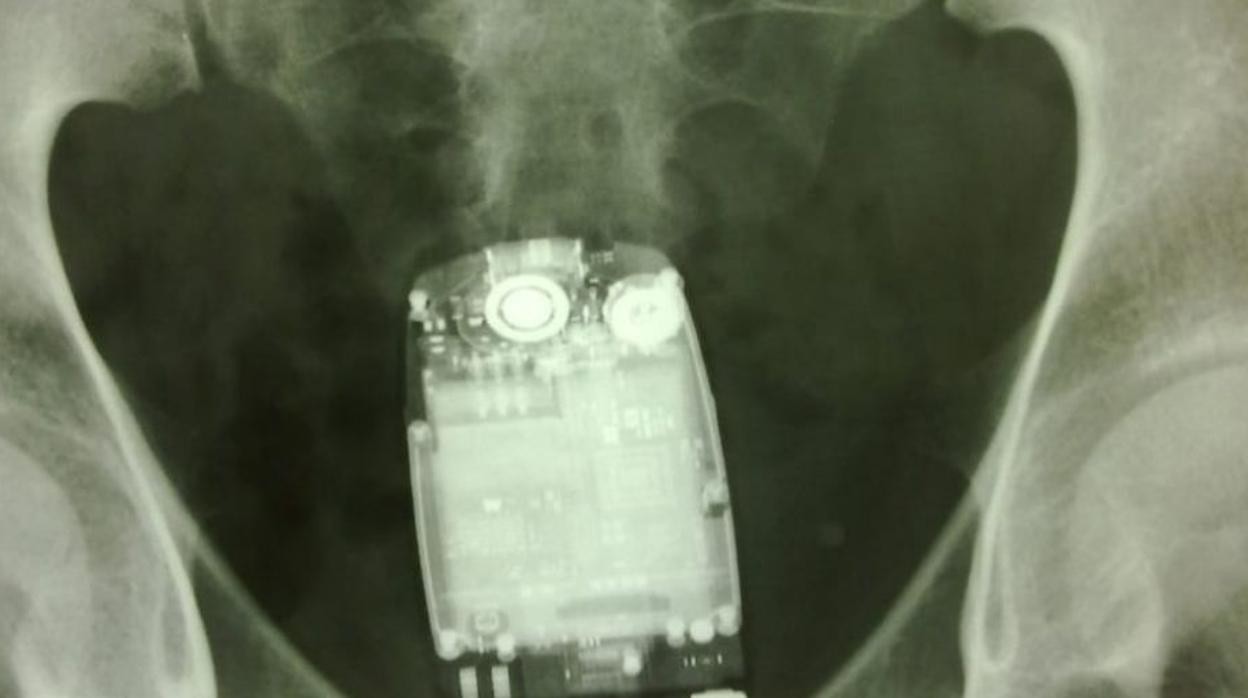 Una imagen de rayos x en la que se observa un teléfono móvil