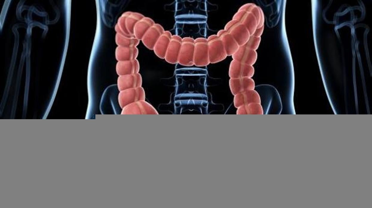 El cáncer de colon es uno de los más frecuentes