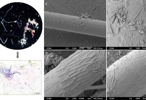 Imagen de las fibras analizadas al microscopio y las bacterias halladas en ellas aportados por el estudio.