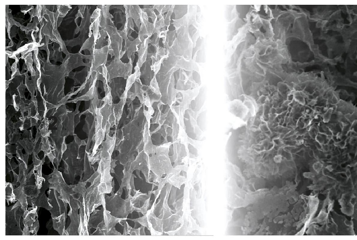 Microfotografía del electrodo de grafeno de este novedoso sistema