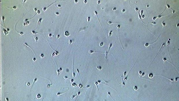Científicos españoles logran el primer paso para crear espermatozoides a partir de la piel