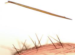 Los pelos urticantes