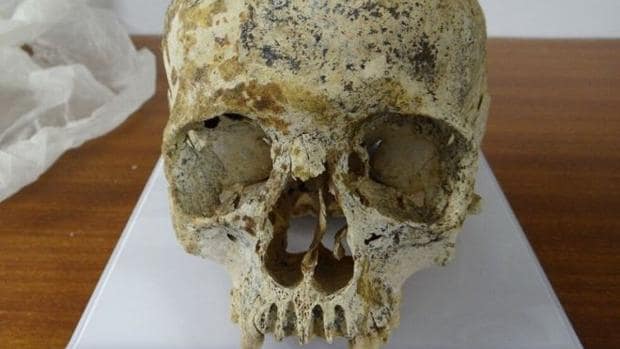 El cráneo de «Ava» es redondo y pequeño, como si hubiera sido vendado durante el crecimiento o a causa de su herencia genética