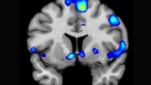 Varias regiones del cerebro se activan en una experiencia espiritual, que incluye un circuito de recompensa, el núcleo accumbens.