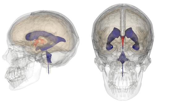 Localización de los ventrículos cerebrales