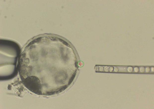 Inyección de células humanas en en el interior de un embrión de cerdo