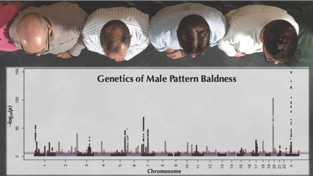 Los investigadores no han podido hacer una fórmula que permita decirle a un individuo qué riesgo tiene de quedarse calvo, pero sí identificar grupos de población donde es más probable que aparezca la alopecia