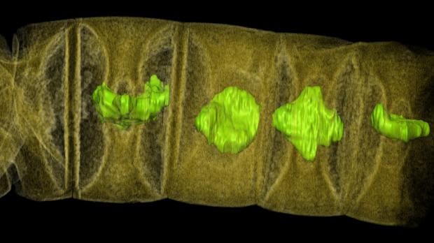 «Fotografía» al microscopio de rayos X del fósil. Su hallazgo adelanta la aparición de la vida multiceular en 400 millones de años